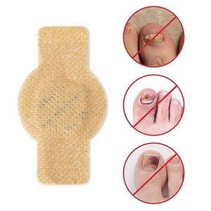 PARCHES PARA HONGOS EN LAS UÑAS - PAGA 1 LLEVA 2