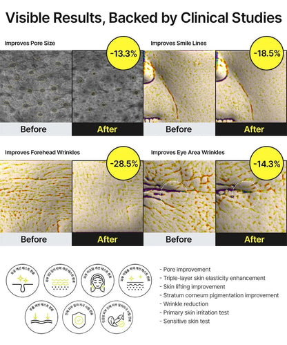 BOOSTER RETINAL SHOT CELIMAX