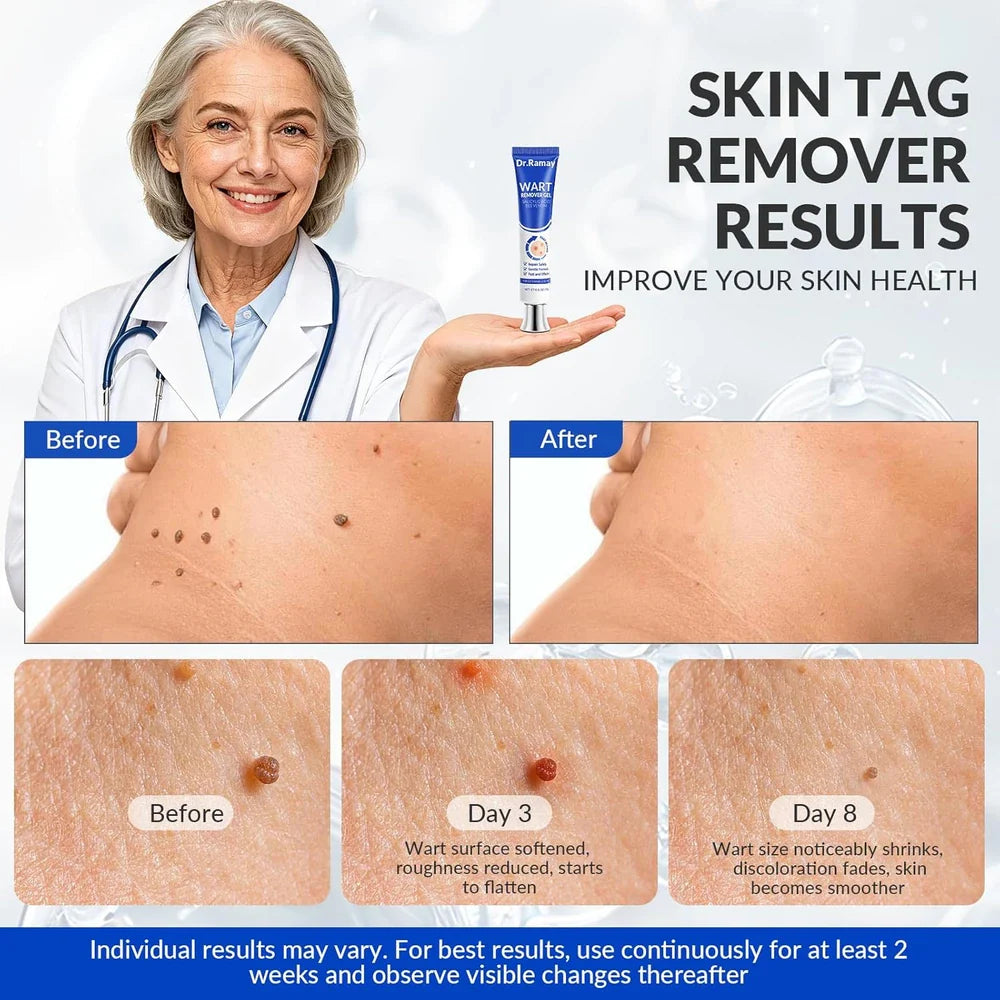 GEL VERRUGAS MAÍZ ÁCIDO SALICÍLICO 20%