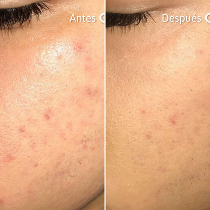 NIACID SUERO REPARADOR CUTÁNEO