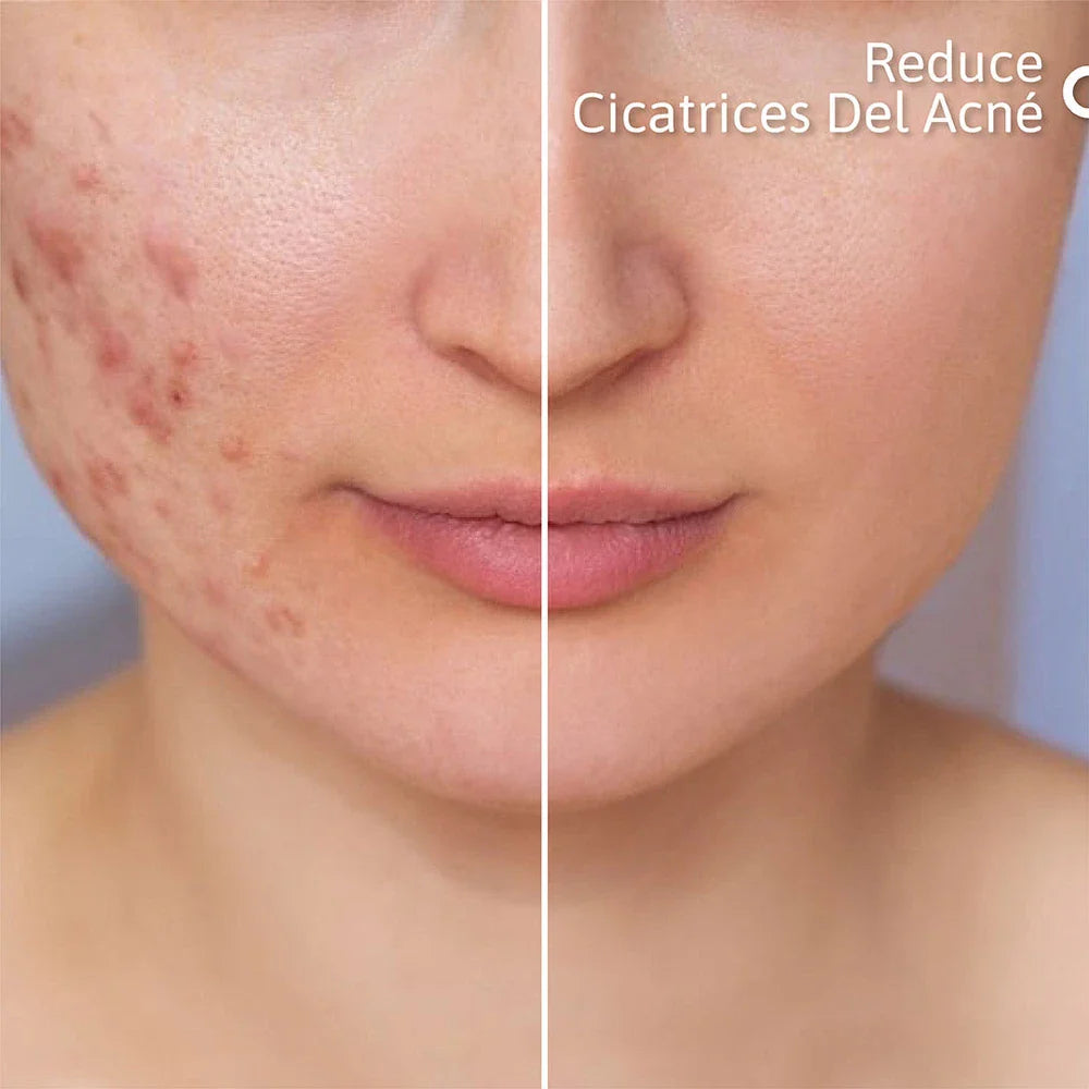 NIACID SUERO REPARADOR CUTÁNEO