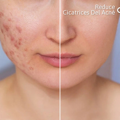 NIACID SUERO REPARADOR CUTÁNEO