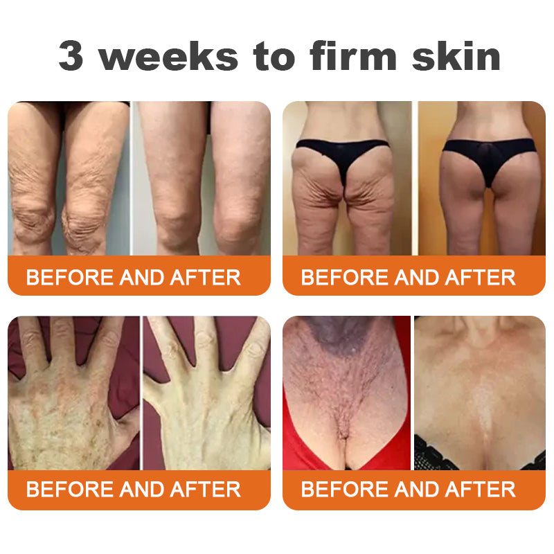 Barra de Suero Reafirmante con Veneno de Abeja y Botox