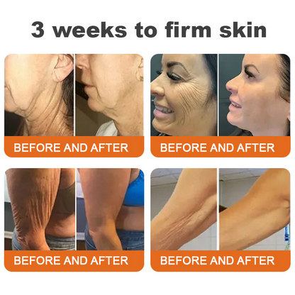 Barra de Suero Reafirmante con Veneno de Abeja y Botox