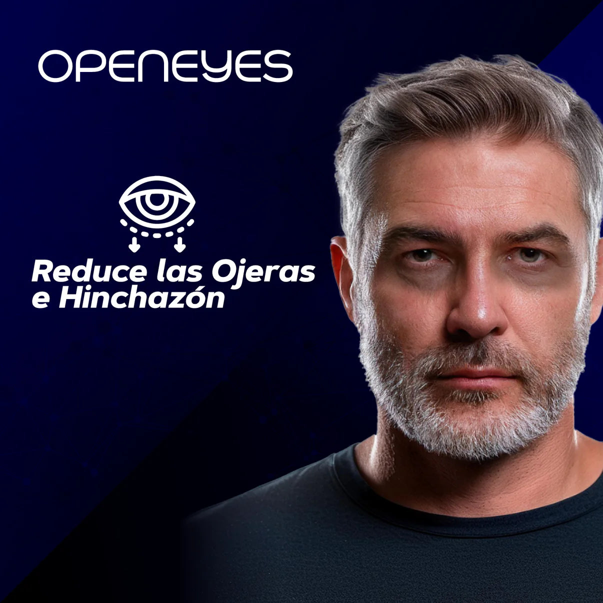 CREMA PARA BOLSAS EN LOS OJOS