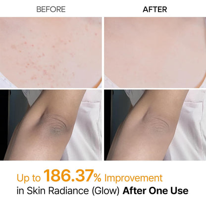 SPRAY EXFOLIANTE CORPORAL RADIANTE DIARIO
