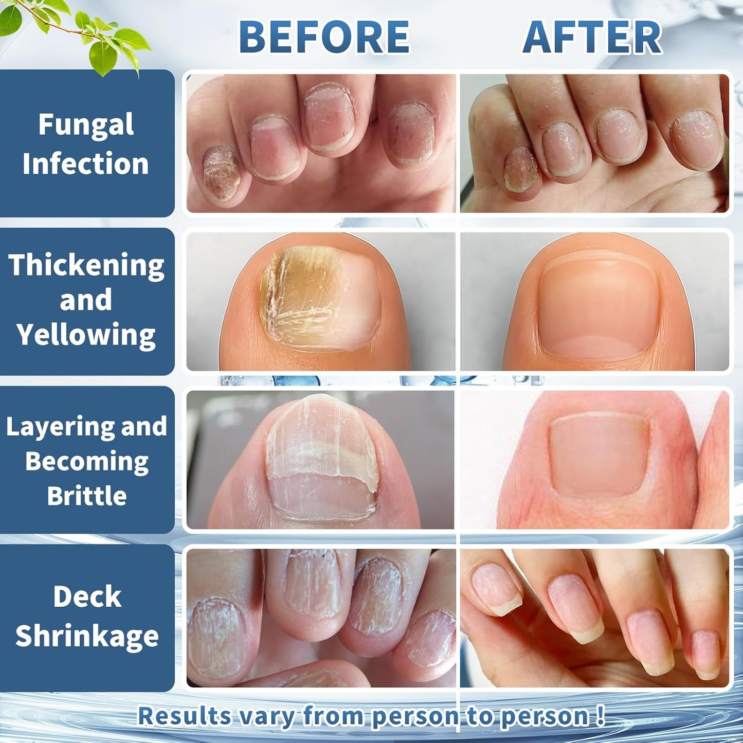 SÉRUM REPARADOR DE UÑAS