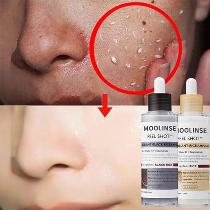SERUM EXFOLIANTE DE ARROZ