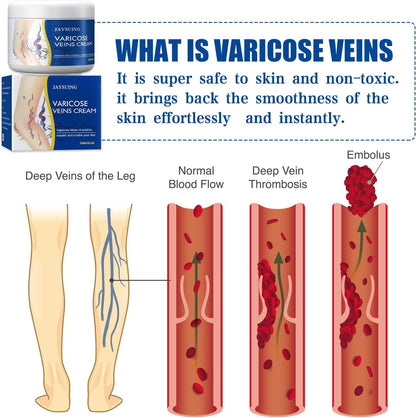 CREMA MÁGICA PARA VENAS VARICES