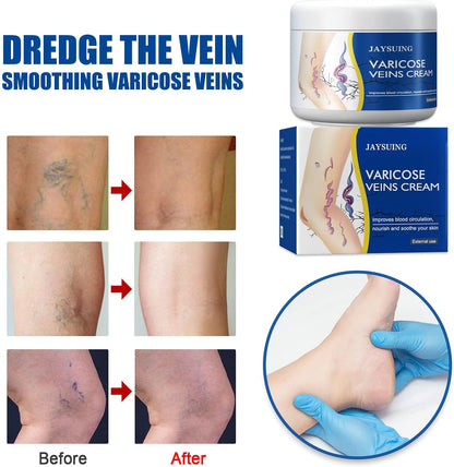 CREMA MÁGICA PARA VENAS VARICES
