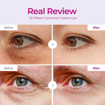 PARCHES OJOS VOLUMINIZANTES DR.MELAXIN