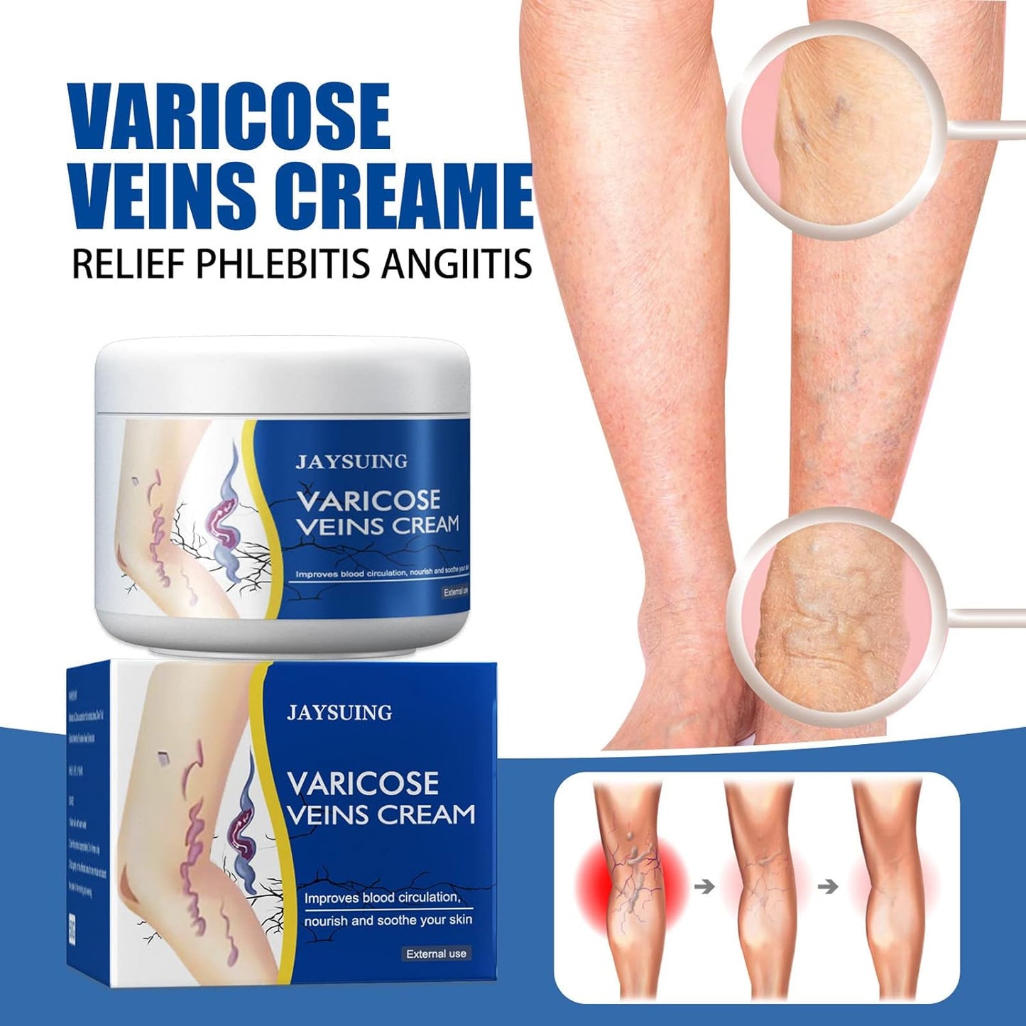 CREMA MÁGICA PARA VENAS VARICES