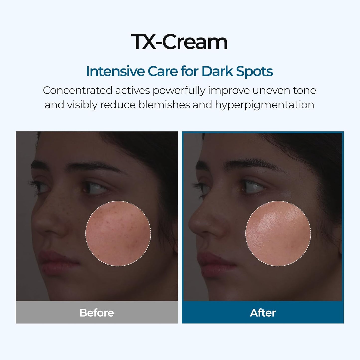 CREMA TRANEXÁMICA RADIANTE