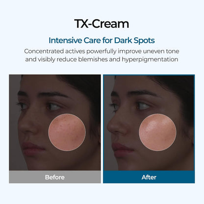 CREMA TRANEXÁMICA RADIANTE