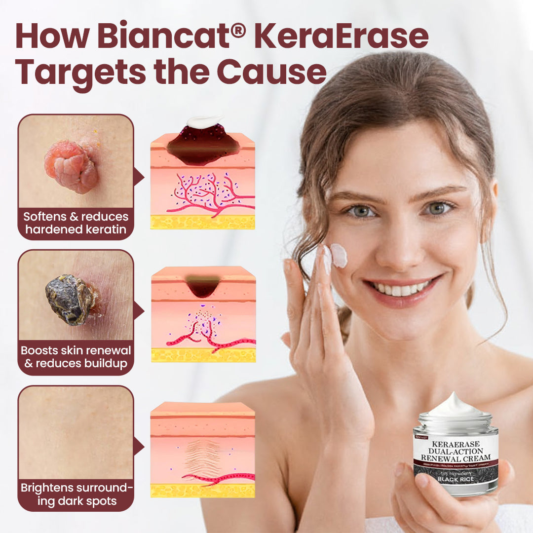 KERAERASE CREMA RENOVADORA