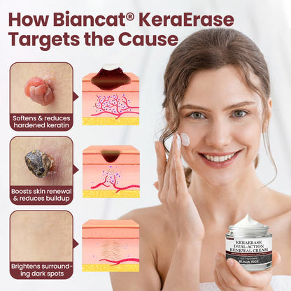 KERAERASE CREMA RENOVADORA