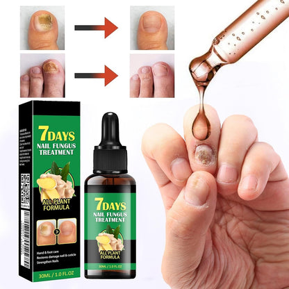 TRATAMIENTO DE UÑAS JAYSUING DE 7 DÍAS, SUERO NATURAL