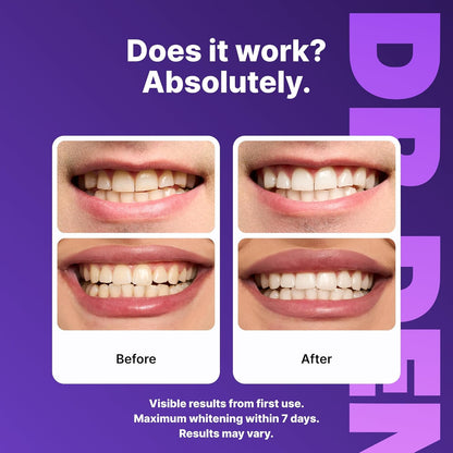 TIRAS BLANQUEADORAS DENTALES-PACK X 40