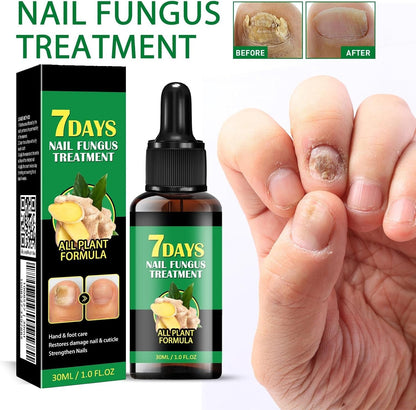 TRATAMIENTO DE UÑAS JAYSUING DE 7 DÍAS, SUERO NATURAL